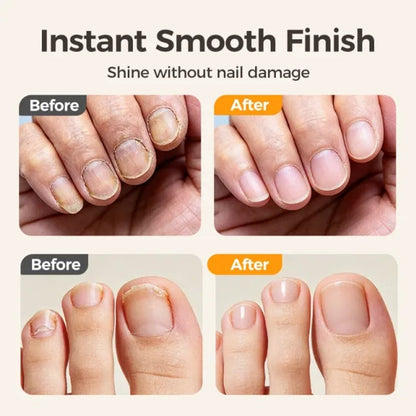 2-in-1 Smart Electric Nail Trimmer & Polisher for All Ages